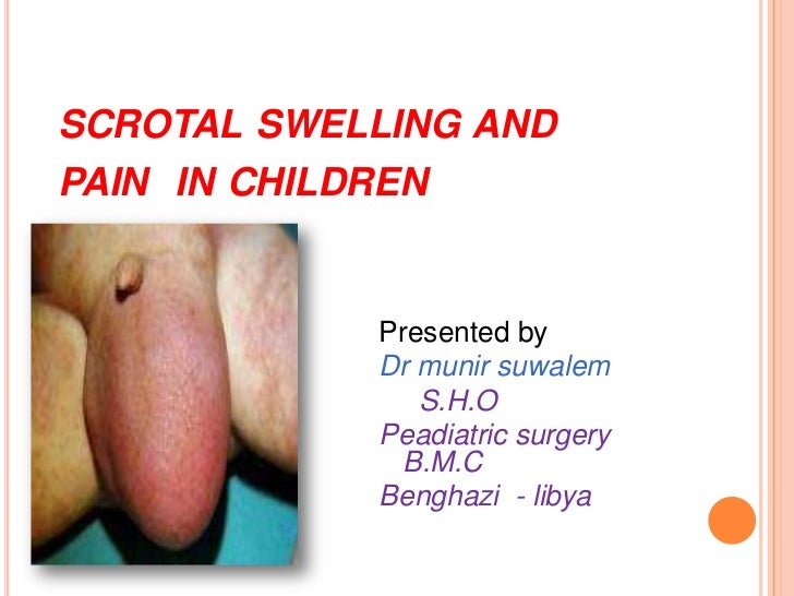 swelling of penis pain boys Swelling of penis pain boys